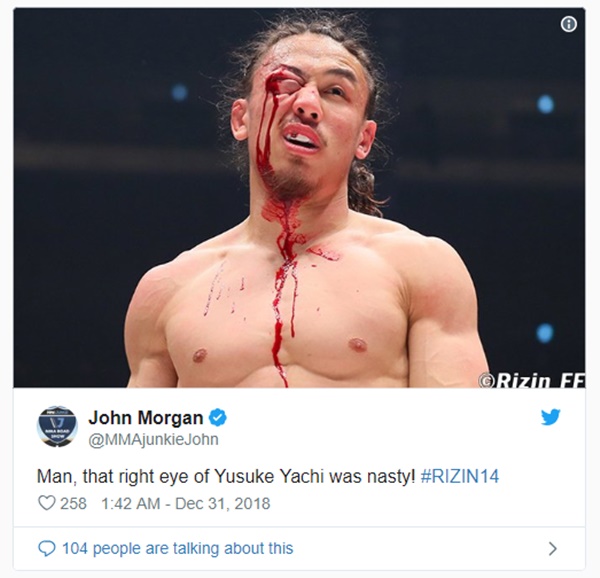 Yusuke Yachi Suffers Disgusting Eye Injury at RIZIN14