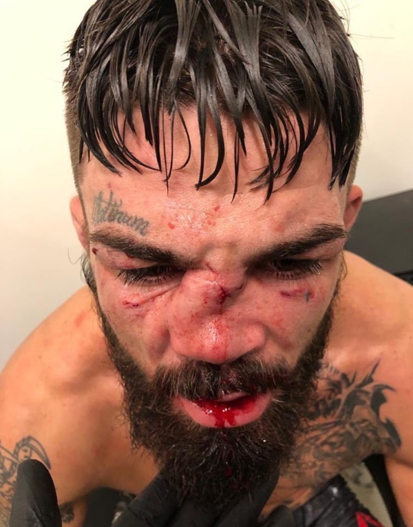 Mike Perry's nose badly broken
