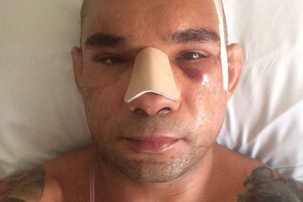 Evangelista Cyborg Santos injury