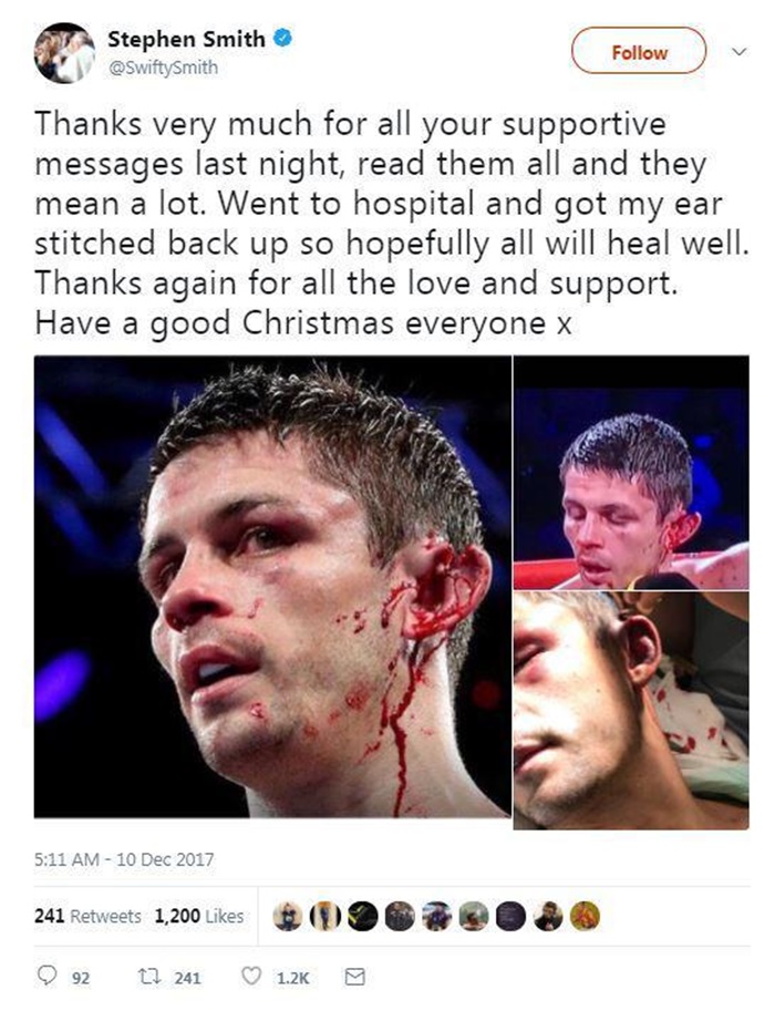 Boxer Stephen Smith Recovering After Ear Almost Gruesomely Torn Off in Fight