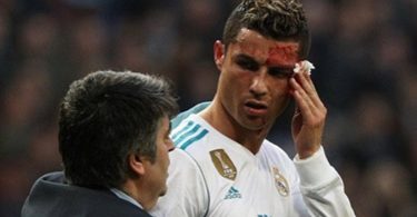NOOOO...NOT The Face! Cristiano Ronaldo Gets Bloody Win