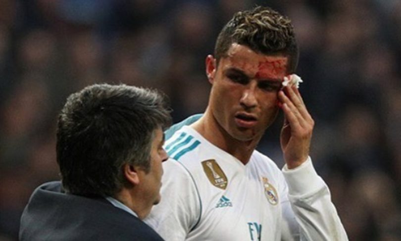 NOOOO...NOT The Face! Cristiano Ronaldo Gets Bloody Win