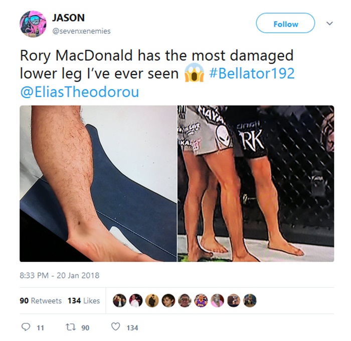 Rory MacDonald Won Bellator with Disgusting Leg Injury