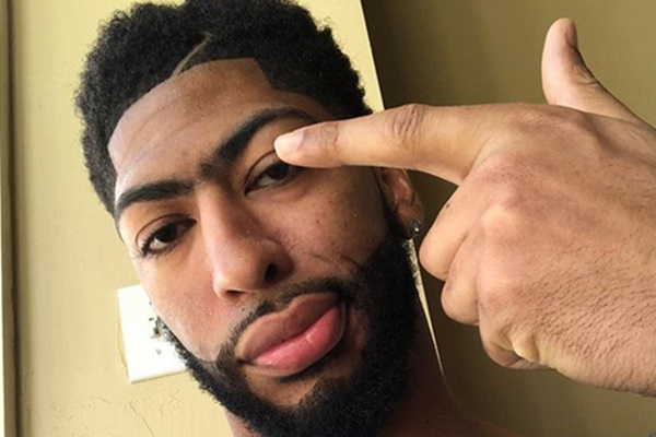 Anthony Davis Breaks Silence Since Being Traded