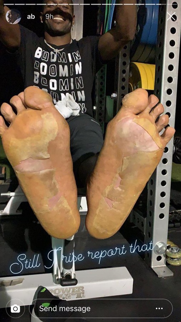 No Sucking on Antonio Brown's Feet; They NASTY