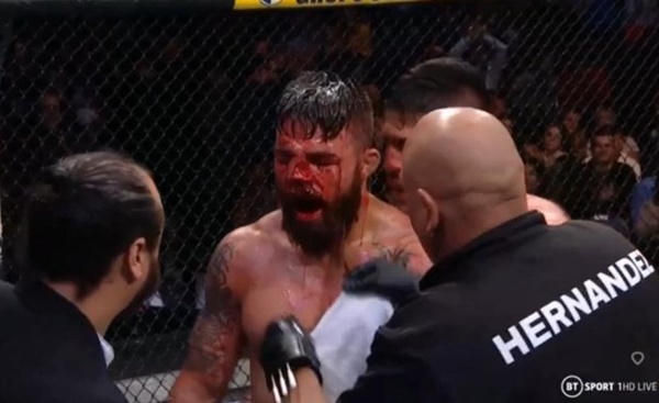 Mike Perry's Bloody Nose is Disgusting
