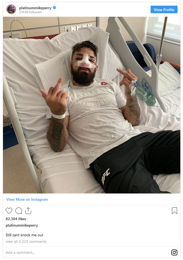 Mike Perry's recovery from nose surgery