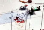 IceDogs Tucker Tynan Suffers Disgustingly Bloody Injury
