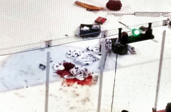 IceDogs Tucker Tynan Suffers Disgustingly Bloody Injury