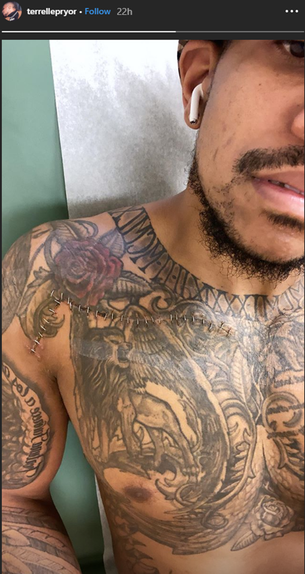 Terrelle Pryor Shows Off Stabbing Love Stitches