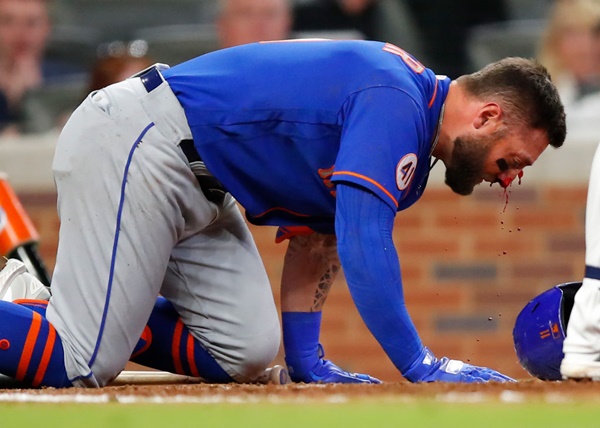 Kevin Pillar Bloody After DRILLED In The Face By 94-MPH Fastball